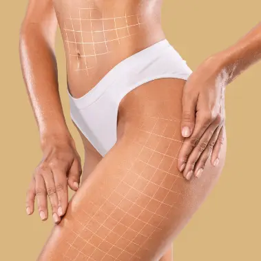 Renuvion skin tightening service – minimally invasive skin tightening at HealthExcel