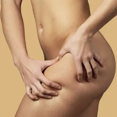 Lipoedema treatment service – specialist care and surgical support at HealthExcel