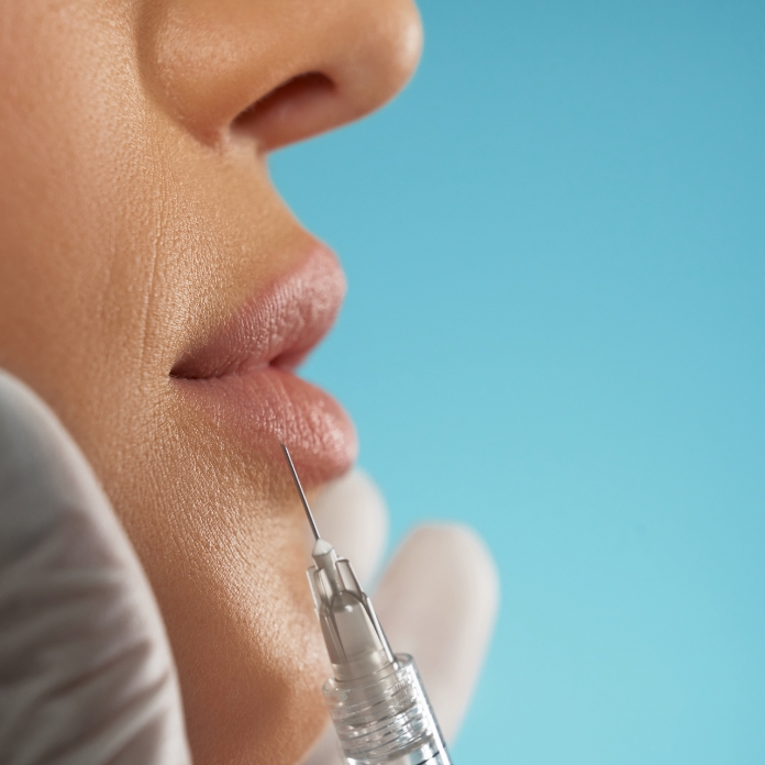 Dermal fillers service – facial volume and contouring at HealthExcel