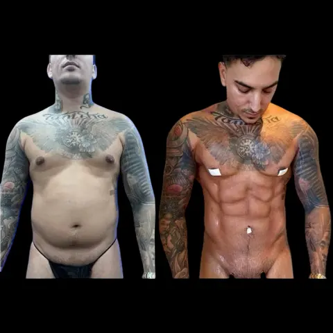 Dr Fasano Featured on ITV’s Price of Perfection